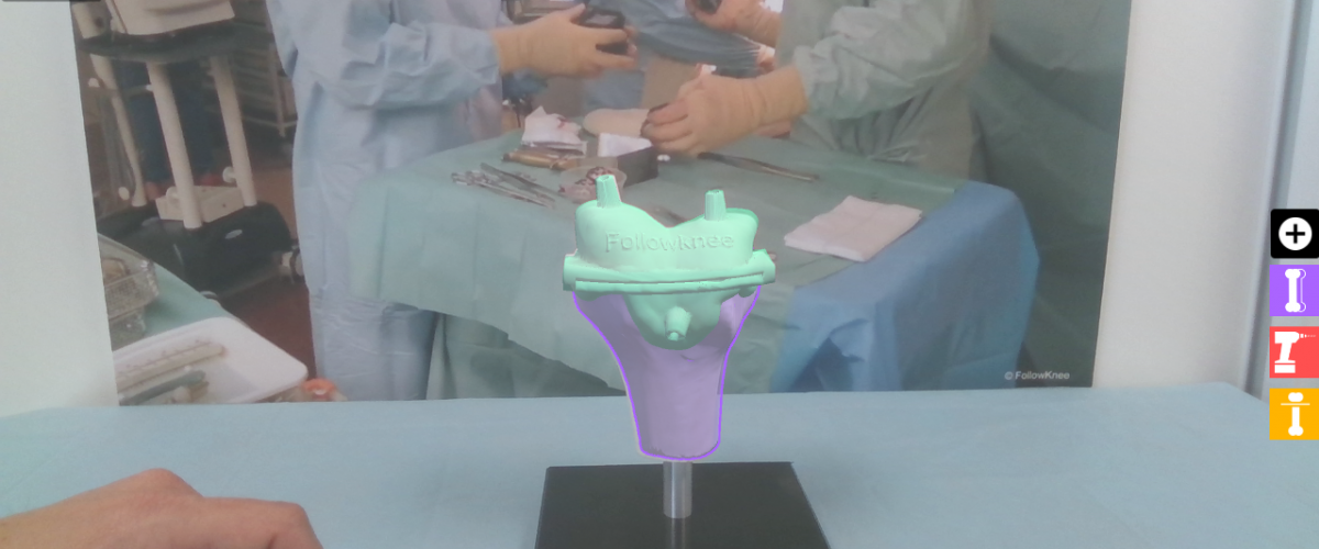 augmented reality, knee surgery, followknee 