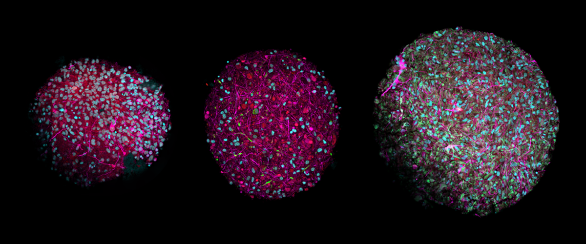 Organoid Intelligence